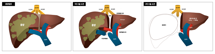 건강-온 종합 2.png